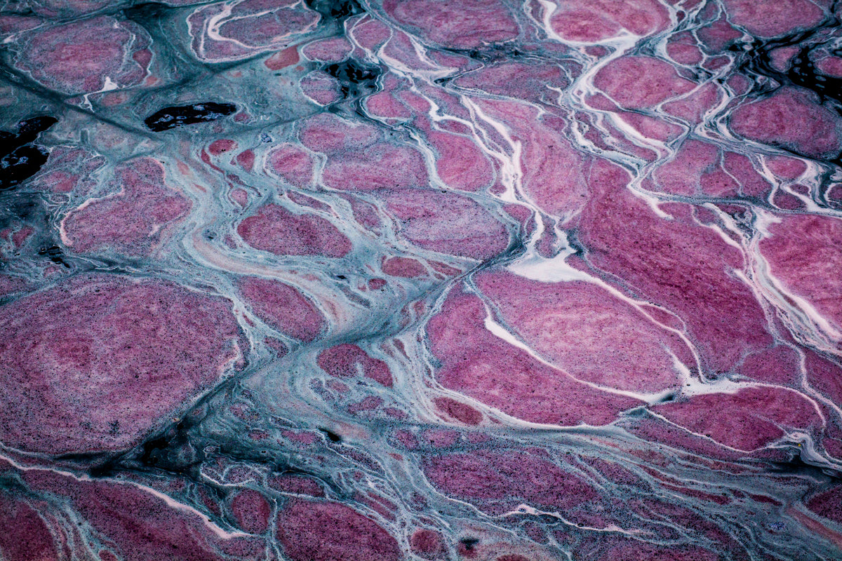 Microscopic view of tissue with pink and purple harmful dies